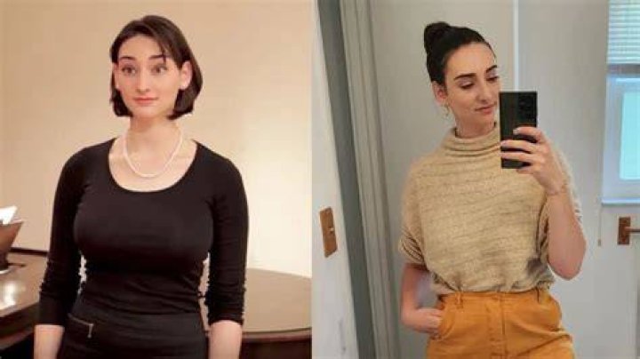 Abby Shapiro plastic surgery