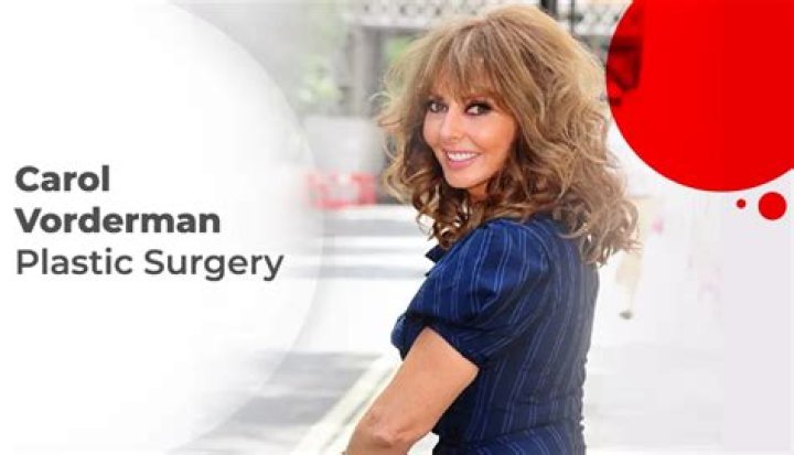 Carol Vorderman Plastic Surgery:&nbsp;She Get Little Things Done