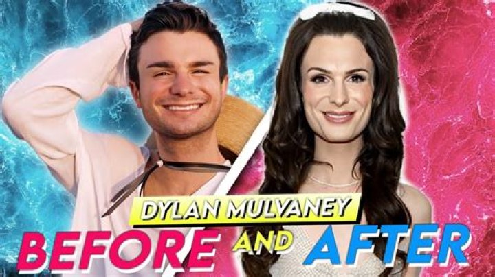 Dylan Mulvaney Before And After Plastic Surgery Photo