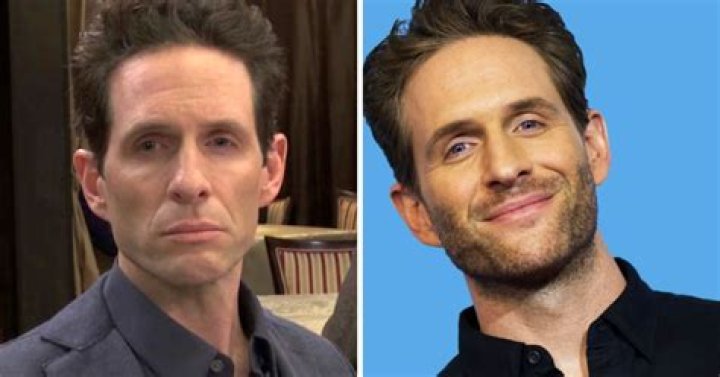glenn howerton plastic surgery