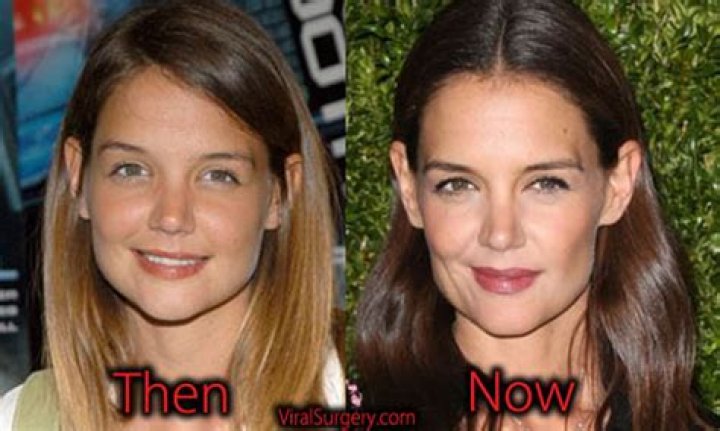 Katie Holmes Nose Job Plastic Surgery Before and After